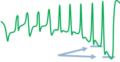 2-Obvervation SmO2 en réponse à la charge du test moxy 5-1-5
