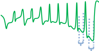 5-Obsvervation SmO2 en réponse à la charge du test moxy 5-1-5