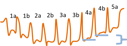 8-Obsvervation THb en réponse à la charge du test moxy 5-1-5